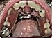 prosthodontics